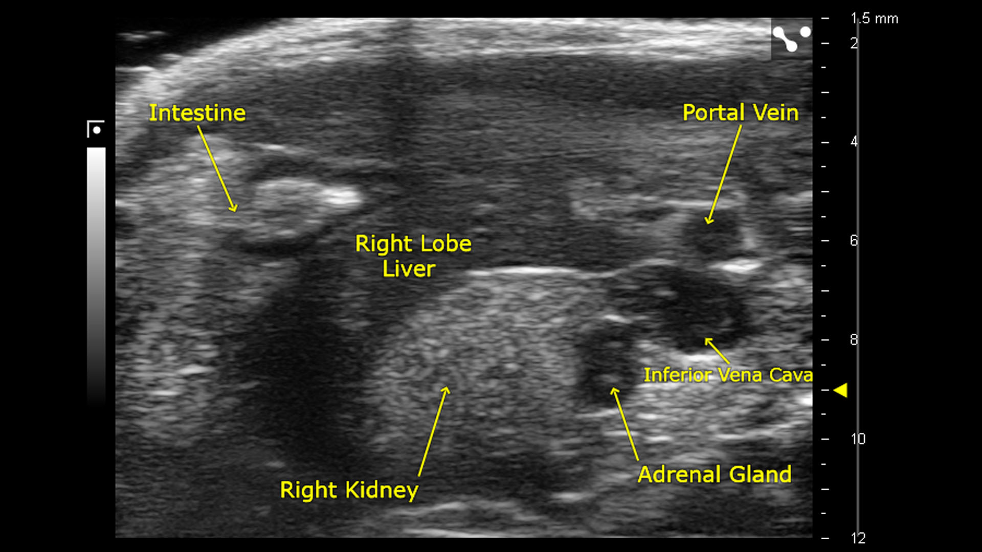 Hepatic Research | FUJIFILM VisualSonics